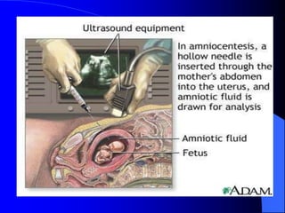 POLYHYDRAMNIOS AND OLIGOHYDRAMNIOS.ppt