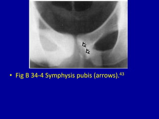 • Fig B 34-4 Symphysis pubis (arrows).43