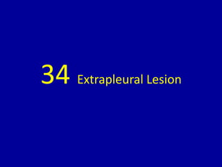 34 Extrapleural Lesion
 