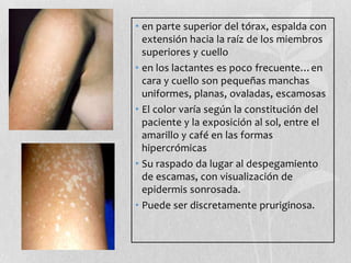 • en parte superior del tórax, espalda con
extensión hacia la raíz de los miembros
superiores y cuello
• en los lactantes es poco frecuente…en
cara y cuello son pequeñas manchas
uniformes, planas, ovaladas, escamosas
• El color varía según la constitución del
paciente y la exposición al sol, entre el
amarillo y café en las formas
hipercrómicas
• Su raspado da lugar al despegamiento
de escamas, con visualización de
epidermis sonrosada.
• Puede ser discretamente pruriginosa.

 