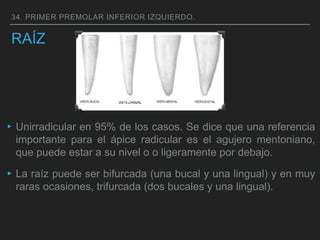 RAÍZ
▸Unirradicular en 95% de los casos. Se dice que una referencia
importante para el ápice radicular es el agujero mentoniano,
que puede estar a su nivel o o ligeramente por debajo.
▸La raíz puede ser bifurcada (una bucal y una lingual) y en muy
raras ocasiones, trifurcada (dos bucales y una lingual).
34. PRIMER PREMOLAR INFERIOR IZQUIERDO.
 