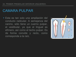 CAMARA PULPAR
▸Esta es tan solo una ampliación del
conducto radicular. A semejanza del
canino, sólo tiene un cuerno pulpar,
el vestibular, ya que el lingual es
efímero, así como el techo pulpar. Es
de forma convide y recto, como
corresponde a la raíz.
34. PRIMER PREMOLAR INFERIOR IZQUIERDO.
 
