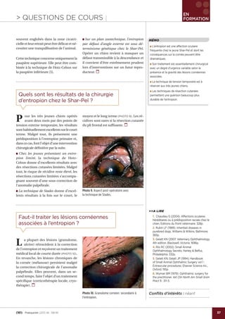 37
EN
FORMATION
jj> QUESTIONS DE COURS
(161) PratiqueVet (2011) 46 : 158-161
Faut-il traiter les lésions cornéennes
associées à l’entropion ?
Quels sont les résultats de la chirurgie
d’entropion chez le Shar-Peï ?
L a plupart des lésions (granulome,
ulcère) rétrocèdent à la correction
de l’entropion et reçoivent un traitement
médical local de courte durée (PHOTO 10).
En revanche, les lésions chroniques de
la cornée (mélanose) persistent malgré
la correction chirurgicale de l’anomalie
palpébrale. Elles peuvent, dans un se-
cond temps, faire l’objet d’un traitement
spéciﬁque (corticothérapie locale, cryo-
thérapie).
P our les très jeunes chiots opérés
avant deux mois par des points de
tension externe temporaire, les résultats
sonthabituellementexcellentssurlecourt
terme. Malgré tout, ils présentent une
prédisposition à l’entropion primaire et,
danscecas,fontl’objetd’uneintervention
chirurgicale déﬁnitive par la suite.
■ Chez les jeunes présentant un entro-
pion limité, la technique de Hotz-
Celsus donne d’excellents résultats avec
des résections cutanées limitées. Malgré
tout, le risque de récidive reste élevé, les
résections cutanées limitées s’accompa-
gnant souvent d’une sous-correction de
l’anomalie palpébrale.
■ La technique de Stades donne d’excel-
lents résultats à la fois sur le court, le
moyen et le long terme (PHOTO 9). Les ré-
cidives sont rares si la résection cutanée
du pli frontal est sufﬁsante.
souvent englobés dans la zone cicatri-
cielle et leur retrait peut être délicat et né-
cessiter une tranquillisation de l’animal.
Cette technique concerne uniquement la
paupière supérieure. Elle peut être com-
binée à la technique de Hotz-Celsus sur
la paupière inférieure [5].
■ Sur un plan zootechnique, l’entropion
par défaut d’angle externe est sous dé-
terminisme génétique chez le Shar-Peï.
Opérer un chien revient à masquer un
défaut transmissible à la descendance et
il convient d’être extrêmement prudent
lors d’interventions sur un futur repro-
ducteur.
>>A LIRE
1. Chaudieu G (2004). Affections oculaires
héréditaires ou à prédisposition raciale chez le
chien, Editions du Point vétérinaire. 328p.
2. Rubin LF (1989). Inherited diseases in
purebred dogs. Williams & Wilkins, Baltimore.
383p.
3. Gelatt KN (2007. Veterinary Ophthalmology.
4th edition. Blackwell, Victoria. 1696p.
4. Riis RC (2002). Small Animal
Ophthalmology Secrets. Hanley & Belfus,
Philadelphia. 332p.
5. Gelatt KN, Gelatt JP (1994). Handbook
of Small Animal Ophthalmic Surgery vol 1 :
Extraocular procedures. Elsevier Science Inc.,
Oxford. 195p
6. Wyman BM (1979). Ophthalmic surgery for
the practitioner. Vet Clin North Am Small Anim
Pract 9 : 311-3.
MÉMO
■ L’entropion est une affection oculaire
fréquente chez le jeune Shar-Peï et dont les
conséquences sur la cornée peuvent être
dramatiques.
■ Son traitement est essentiellement chirurgical
avec un degré d’urgence variable selon la
présence et la gravité des lésions cornéennes
associées.
■ La technique de tension temporaire est à
réserver aux très jeunes chiens.
■ Les techniques de résection cutanées
permettent une guérison beaucoup plus
durable de l’entropion.
Conﬂits d’intérêts : néantPhoto 10. Granulome cornéen secondaire à
l’entropion.
Photo 9. Aspect post-opératoire avec
la technique de Stades.
 