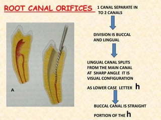   Buccolingual width  -   wide
