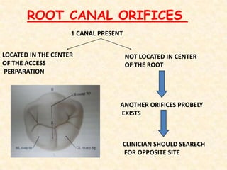 Mandibular 2nd premolar