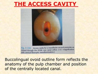 Mandibular 2nd premolarAnatomic relationships in situThe mental canal and foramen are close to the root apex Radiograph appearance may shows peiapical pathosis