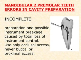 THE ACCESS CAVITY The access cavity form for the Mandibular second premolar varies in at least two ways in its external anatomy.1.The crown typically has a smaller lingual inclination less extension up the buccal cusp incline is required to achieve straight-line access. 2. The lingual half of the tooth is more fully developed; therefore the lingual access extension is typically halfway up the lingual cusp incline. 