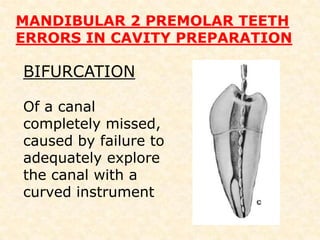 THE ACCESS CAVITY The Mandibular second premolar can have two lingual cusps, sometimes of equal size. When this occurs, the access preparation is centered mesiodistally on a line connecting the buccal cusp and the lingual groove between the lingual cusp tips. 