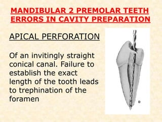 THE ACCESS CAVITY Buccolingual ovoid outline form reflects the anatomy of the pulp chamber and position of the centrally located canal.