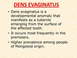 MANDIBULAR 2 PREMOLAR TEETHERRORS IN CAVITY PREPARATIONBIFURCATIONOf a canal completely missed,caused by failure to adequately explore the canal with a curved instrument