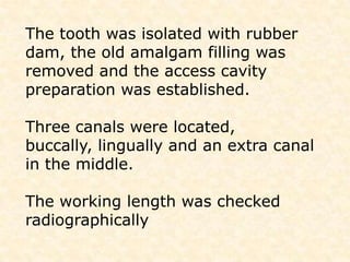   Dilaceration DENS INVAGINATUS  Dens invaginatus is a malformation    of teeth probably resulting from an infolding of the dental papilla during tooth development.  Affected teeth show a deep infolding  of enamel and dentine.  Occurs before calcification of the teeth.  Also known as dens in denteTREATMENT OF DENS INVAGINATUSThe treatment modalities depend on the degree of complexity of its anatomy. 