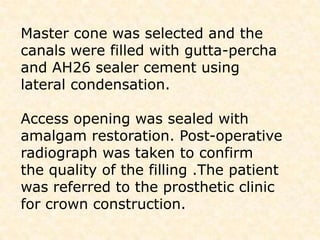 It occurs most frequently in the premolars.