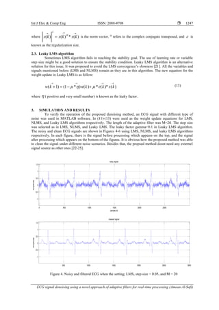 ECG signal denoising using a novel approach of adaptive filters for ...