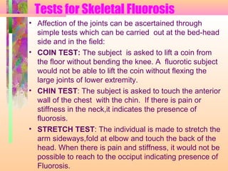 Tests for Skeletal Fluorosis
• Affection of the joints can be ascertained through
simple tests which can be carried out at the bed-head
side and in the field:
• COIN TEST: The subject is asked to lift a coin from
the floor without bending the knee. A fluorotic subject
would not be able to lift the coin without flexing the
large joints of lower extremity.
• CHIN TEST: The subject is asked to touch the anterior
wall of the chest with the chin. If there is pain or
stiffness in the neck,it indicates the presence of
fluorosis.
• STRETCH TEST: The individual is made to stretch the
arm sideways,fold at elbow and touch the back of the
head. When there is pain and stiffness, it would not be
possible to reach to the occiput indicating presence of
Fluorosis.
 