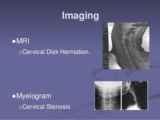 What happens during a cervical myelogram?