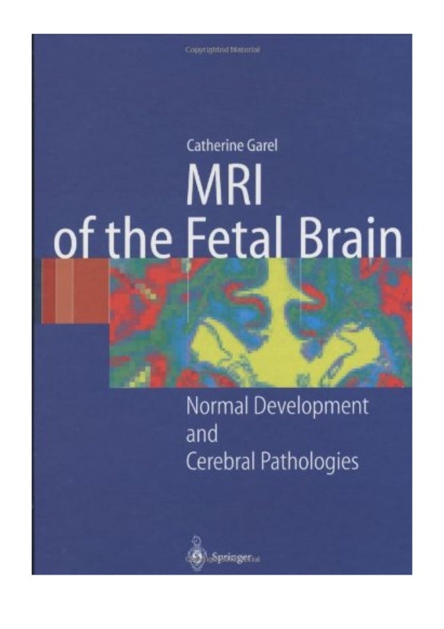 (2004) MRI of the Fetal Brain (PDF) Normal Development and Cerebral