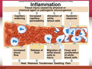 Comprehensive Overview of Inflammation and Pain Pathophysiology | PPT