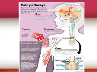 Comprehensive Overview of Inflammation and Pain Pathophysiology | PPT