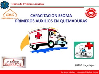 Curso de Primeros Auxilios
CAPACITACION SSOMA
PRIMEROS AUXILIOS EN QUEMADURAS
La seguridad es responsabilidad de todos
AUTOR:Jorge Lujan
 