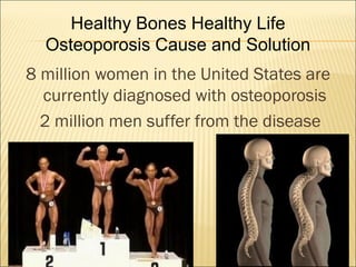 8 million women in the United States are
currently diagnosed with osteoporosis
2 million men suffer from the disease
Healthy Bones Healthy Life
Osteoporosis Cause and Solution
 