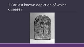 2.Earliest known depiction of which
disease?
 
