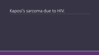 Kaposi’s sarcoma due to HIV.
 