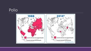 Polio
 