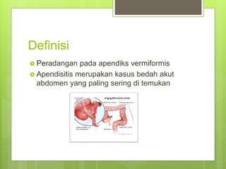 Definisi
 Peradangan pada apendiks vermiformis
 Apendisitis merupakan kasus bedah akut
abdomen yang paling sering di temukan
 