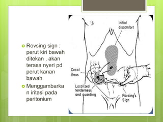  Rovsing sign :
perut kiri bawah
ditekan , akan
terasa nyeri pd
perut kanan
bawah
 Menggambarka
n iritasi pada
peritonium
 