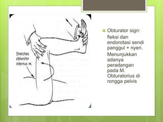  Obturator sign:
fleksi dan
endorotasi sendi
panggul + nyeri.
Menunjukkan
adanya
peradangan
pada M.
Obturatorius di
rongga pelvis
 