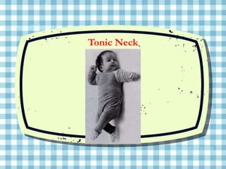 Sucking
Tonic Neck
 