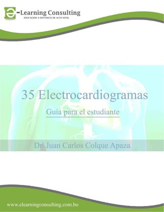 35 electrocardiogramas parte 2
