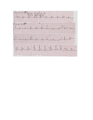 35 electrocardiogramas parte 2