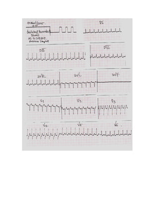 35 electrocardiogramas parte 2