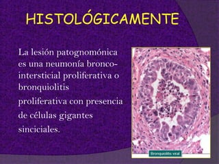 HISTOLÓGICAMENTE

La lesión patognomónica
es una neumonía bronco-
intersticial proliferativa o
bronquiolitis
proliferativa con presencia
de células gigantes
sinciciales.
 