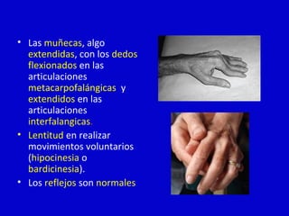 • Las muñecas, algo 
extendidas, con los dedos 
flexionados en las 
articulaciones 
metacarpofalángicas y 
extendidos en las 
articulaciones 
interfalangicas. 
• Lentitud en realizar 
movimientos voluntarios 
(hipocinesia o 
bardicinesia). 
• Los reflejos son normales. 
 