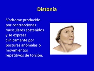 Distonía 
Síndrome producido 
por contracciones 
musculares sostenidos 
y se expresa 
clínicamente por 
posturas anómalas o 
movimientos 
repetitivos de torsión. 
 