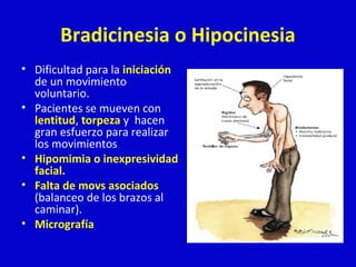 Bradicinesia o Hipocinesia 
• Dificultad para la iniciación 
de un movimiento 
voluntario. 
• Pacientes se mueven con 
lentitud, torpeza y hacen 
gran esfuerzo para realizar 
los movimientos 
• Hipomimia o inexpresividad 
facial. 
• Falta de movs asociados 
(balanceo de los brazos al 
caminar). 
• Micrografía 
 