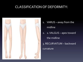 CLASSIFICATION OF DEFORMITY:
1. VARUS – away from the
midline
2. 2.VALGUS – apex toward
the midline
3. RECURVATUM – backward
curvature
 