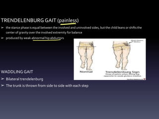TRENDELENBURG GAIT (painless)
➢ the stance phase is equal between the involved and uninvolved sides, but the child leans or shifts the
center of gravity over the involved extremity for balance
➢ produced by weak abnormal hip abductors
WADDLING GAIT
➢ Bilateral trendelenburg
➢ The trunk is thrown from side to side with each step
-
=
 