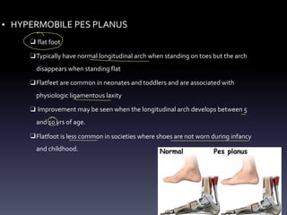 • HYPERMOBILE PES PLANUS
❑ flat foot
❑Typically have normal longitudinal arch when standing on toes but the arch
disappears when standing flat
❑Flatfeet are common in neonates and toddlers and are associated with
physiologic ligamentous laxity
❑ Improvement may be seen when the longitudinal arch develops between 5
and 10 yrs of age.
❑Flatfoot is less common in societies where shoes are not worn during infancy
and childhood.
②
-
-
-
O
- -
 