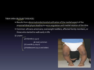 TIBIAVARA (BLOUNT DISEASE)
➢Results from abnormal endochondral osification of the medial aspect of the
proximal tibial physis leading to varus angulation and medial rotation of the tibia
➢Common: africans-americans; overweight toddlers, affected family members, or
those who started to walk early in life
❑ 3 types:
❑ Infantile (1-3y.o)
❑ most common
❑ Juvenile (4-10y.o)
❑ Adolescent (11y.o and older)
- -
-
- - - -
---
[
 