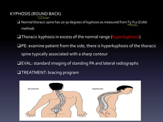 KYPHOSIS (ROUND BACK)
❑ Normal thoracic spine has 20-50 degrees of kyphosis as measured fromT3-T12 (Cobb
method)
❑Thoracic kyphosis in excess of the normal range (hyperkyphosis)
❑PE: examine patient from the side, there is hyperkyphosis of the thoracic
spine typically associated with a sharp contour
❑EVAL: standard imaging of standing PA and lateral radiographs
❑TREATMENT: bracing program
&
-
>
°
⑦
°
-
↑
 