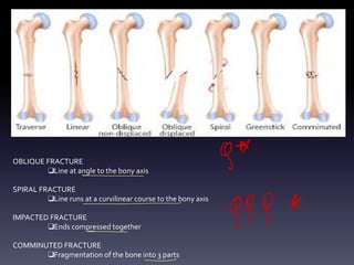 OBLIQUE FRACTURE
❑Line at angle to the bony axis
SPIRAL FRACTURE
❑Line runs at a curvilinear course to the bony axis
IMPACTED FRACTURE
❑Ends compressed together
COMMINUTED FRACTURE
❑Fragmentation of the bone into 3 parts
g
*
=
999
A
-
- -
 