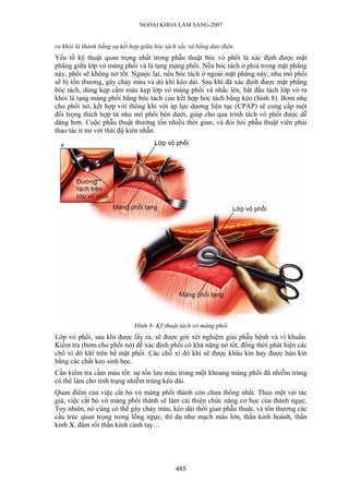NGOẠI KHOA LÂM SÀNG-2007


ra khỏi lá thành bằng sự kết hợp giữa bóc tách sắc và bằng dao điện.
Yếu tố kỹ thuật quan trọng nhất trong phẫu thuật bóc vỏ phổi là xác định được mặt
phẳng giữa lớp vỏ màng phổi và lá tạng màng phổi. Nếu bóc tách ở phiá trong mặt phẳng
này, phổi sẽ không nở tốt. Ngược lại, nếu bóc tách ở ngoài mặt phẳng này, nhu mô phổi
sẽ bị tổn thương, gây chảy máu và dò khí kéo dài. Sau khi đã xác định được mặt phẳng
bóc tách, dùng kẹp cầm máu kẹp lớp vỏ màng phổi và nhấc lên, bắt đầu tách lớp vỏ ra
khỏi lá tạng màng phổi bằng bóc tách cùn kết hợp bóc tách bằng kéo (hình 8). Bơm nhẹ
cho phổi nở, kết hợp với thông khí với áp lực dương liên tục (CPAP) sẽ cung cấp một
đối trọng thích hợp từ nhu mô phổi bên dưới, giúp cho qua trình tách vỏ phổi được dễ
dàng hơn. Cuộc phẫu thuật thường tốn nhiều thời gian, và đòi hỏi phẫu thuật viên phải
thao tác tỉ mỉ với thái độ kiên nhẫn.




                              Hình 8- Kỹ thuật tách vỏ màng phổi
Lớp vỏ phổi, sau khi được lấy ra, sẽ được gởi xét nghiệm giải phẫu bệnh và vi khuẩn.
Kiểm tra (bơm cho phổi nở) để xác định phổi có khả năng nở tốt, đồng thời phát hiện các
chổ xì dò khí trên bề mặt phổi. Các chỗ xì dò khí sẽ được khâu kín hay được hàn kín
bằng các chất keo sinh học.
Cần kiểm tra cầm máu tốt: sự tồn lưu máu trong một khoang màng phổi đã nhiễm trùng
có thể làm cho tình trạng nhiễm trùng kéo dài.
Quan điểm của việc cắt bỏ vỏ màng phổi thành còn chưa thống nhất. Theo một vài tác
giả, việc cắt bỏ vỏ màng phổi thành sẽ làm cải thiện chức năng cơ học của thành ngực.
Tuy nhiên, nó cũng có thể gây chảy máu, kéo dài thời gian phẫu thuật, và tổn thương các
cấu trúc quan trọng trong lồng ngực, thí dụ như mạch máu lớn, thần kinh hoành, thần
kinh X, đám rối thần kinh cánh tay…




                                             485
 