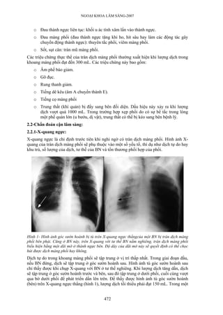 NGOẠI KHOA LÂM SÀNG-2007


   o Đau thành ngực liên tục: khối u ác tính xâm lấn vào thành ngực.
   o Đau màng phổi (đau thành ngực tăng khi ho, hít sâu hay làm các động tác gây
     chuyển động thành ngực): thuyên tắc phổi, viêm màng phổi.
   o Sốt, sụt cân: tràn mũ màng phổi.
Các triệu chứng thực thể của tràn dịch màng phổi thường xuất hiện khi lượng dịch trong
khoang màng phổi đạt đến 300 mL. Các triệu chứng này bao gồm:
   o Âm phế bào giảm.
   o Gõ đục.
   o Rung thanh giảm.
   o Tiếng dê kêu (âm A chuyển thành E).
   o Tiếng cọ màng phổi
   o Trung thất (khí quản) bị đẩy sang bên đối diện. Dấu hiệu này xảy ra khi lượng
     dịch vượt quá 1000 mL. Trong trường hợp xẹp phổi do có sự bế tắc trong lòng
     một phế quản lớn (u bướu, dị vật), trung thất có thể bị kéo sang bên bệnh lý.
2.2-Chẩn đoán cận lâm sàng:
2.2.1-X-quang ngực:
X-quang ngực là chỉ định trước tiên khi nghi ngờ có tràn dịch màng phổi. Hình ảnh X-
quang của tràn dịch màng phổi sẽ phụ thuộc vào một số yếu tố, thí dụ như dịch tự do hay
khu trú, số lượng của dịch, tư thế của BN và tổn thương phối hợp của phổi.




Hình 1- Hình ảnh góc sườn hoành bị tù trên X-quang ngực thẳngcủa một BN bị tràn dịch màng
phổi bên phải. Cũng ở BN này, trên X-quang với tư thế BN nằm nghiêng, tràn dịch màng phổi
biểu hiện bằng một dãi mờ ở thành ngực bên. Độ dày của dãi mờ này sẽ quyết định có thể chọc
hút được dịch màng phổi hay không.
Dịch tự do trong khoang màng phổi sẽ tập trung ở vị trí thấp nhất. Trong giai đoạn đầu,
nếu BN đứng, dịch sẽ tập trung ở góc sườn hoành sau. Hình ảnh tù góc sườn hoành sau
chỉ thấy được khi chụp X-quang với BN ở tư thế nghiêng. Khi lượng dịch tăng dần, dịch
sẽ tập trung ở góc sườn hoành trước và bên, sau đó tập trung ở dưới phổi, cuối cùng vượt
qua bờ dưới phổi để phát triển dần lên trên. Để thấy được hình ảnh tù góc sườn hoành
(bên) trên X-quang ngực thẳng (hình 1), lượng dịch tối thiểu phải đạt 150 mL. Trong một


                                           472
 