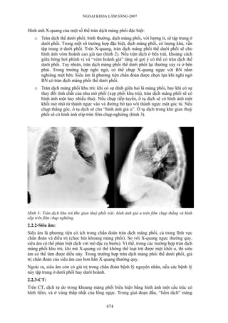 NGOẠI KHOA LÂM SÀNG-2007


Hình ảnh X-quang của một số thể tràn dịch màng phổi đặc biệt:
   o Tràn dịch thể dưới phổi: bình thường, dịch màng phổi, với lượng ít, sẽ tập trung ở
     dưới phổi. Trong một số trường hợp đặc biệt, dịch màng phổi, có lượng khá, vẫn
     tập trung ở dưới phổi. Trên X-quang, tràn dịch màng phổi thể dưới phổi sẽ cho
     hình ảnh vòm hoành cao giả tạo (hình 2). Nếu tràn dịch ở bên trái, khoảng cách
     giữa bóng hơi phình vị và “vòm hoành giả” tăng sẽ gợi ý có thể có tràn dịch thể
     dưới phổi. Tuy nhiên, tràn dịch màng phổi thể dưới phổi lại thường xảy ra ở bên
     phải. Trong trường hợp nghi ngờ, có thể chụp X-quang ngực với BN nằm
     nghiêng một bên. Siêu âm là phương tiện chẩn đoán được chọn lựa khi nghi ngờ
     BN có tràn dịch màng phổi thể dưới phổi.
   o Tràn dịch màng phổi khu trú: khi có sự dính giữa hai lá màng phổi, hay khi có sự
     thay đổi tính chất của nhu mô phổi (xẹp phổi khu trú), tràn dịch màng phổi sẽ có
     hình ảnh một hay nhiều thuỳ. Nếu chụp tiếp tuyến, ổ tụ dịch sẽ có hình ảnh một
     khối mờ nhô từ thành ngực vào và đường bờ tạo với thành ngực một góc tù. Nếu
     chụp thẳng góc, ổ tụ dịch sẽ cho “hình ảnh giả u”. Ổ tụ dịch trong khe gian thuỳ
     phổi sẽ có hình ảnh elip trên film chụp nghiêng (hình 3).




Hình 3- Tràn dịch khu trú khe gian thuỳ phổi trái: hình ảnh giả u trên film chụp thẳng và hình
elip trên film chụp nghiêng.
2.2.2-Siêu âm:
Siêu âm là phương tiện có ích trong chẩn đoán tràn dịch màng phổi, cả trong lĩnh vực
chẩn đoán và điều trị (chọc hút khoang màng phổi). So với X-quang ngực thường quy,
siêu âm có thể phân biệt dịch với mô đặc (u bướu). Vì thế, trong các trường hợp tràn dịch
màng phổi khu trú, khi mà X-quang có thể không thể loại trừ được một khối u, thì siêu
âm có thể làm được điều này. Trong trường hợp tràn dịch màng phổi thể dưới phổi, giá
trị chẩn đoán của siêu âm cao hơn hẳn X-quang thường quy.
Ngoài ra, siêu âm còn có giá trị trong chẩn đoán bệnh lý nguyên nhân, nếu các bệnh lý
này tập trung ở dưới phổi hay dưới hoành.
2.2.3-CT:
Trên CT, dịch tự do trong khoang màng phổi biểu hiện bằng hình ảnh một cấu trúc có
hình liềm, và ở vùng thấp nhất của lồng ngực. Trong giai đoạn đầu, “liềm dịch” màng


                                             474
 