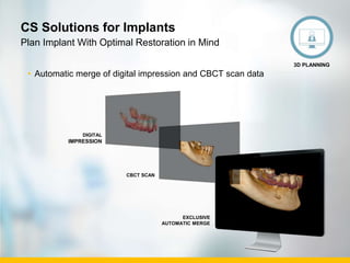 Public. © Carestream Health, 2016
CS Solutions for Implants
• Automatic merge of digital impression and CBCT scan data
Plan Implant With Optimal Restoration in Mind
3D PLANNING
DIGITAL
IMPRESSION
CBCT SCAN
EXCLUSIVE
AUTOMATIC MERGE
 