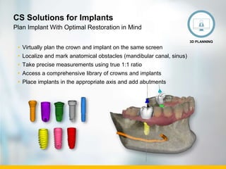 Public. © Carestream Health, 2016
CS Solutions for Implants
• Virtually plan the crown and implant on the same screen
• Localize and mark anatomical obstacles (mandibular canal, sinus)
• Take precise measurements using true 1:1 ratio
• Access a comprehensive library of crowns and implants
• Place implants in the appropriate axis and add abutments
Plan Implant With Optimal Restoration in Mind
3D PLANNING
 