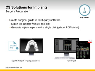 Public. © Carestream Health, 2016
CS Solutions for Implants
• Create surgical guide in third-party software
 Export the 3D data with just one click
 Generate implant reports with a single click (print or PDF format)
Surgery Preparation
PLACEMENT
Export to third-party surgical guide software Implant report
 